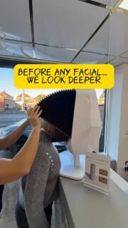 Good skin doesn’t start with products.
It starts with understanding.

At Dermacy Clinic in Doncaster, every facial begins with a professional skin analysis.

Before we touch your skin, we assess it.

Our skin analysis device evaluates:

• Hydration levels
• Pigmentation
• Pore condition
• Sensitivity
• Early signs of ageing
• Underlying skin concerns not visible to the eye

Why does this matter?

Because skincare should never be guesswork.

We use this data to:
– Identify real skin concerns
– Personalise your treatment plan
– Track your progress over time
– Show you where you started and how far you’ve come

For both women and men in Doncaster, this means one thing:

Tailored, evidence-based skincare.
Not generic facials.

When we look back at your results months later, we’re not relying on memory.
We’re looking at measurable change.

If you’re considering a facial treatment in Doncaster, make sure it starts with proper skin analysis.

Your skin deserves more than assumptions.

Dermacy Medical Aesthetic & Laser Clinic
Professional skin analysis & advanced facials
Doncaster