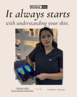 Choosing the right aesthetic treatment isn’t always as simple as it looks.
We meet so many people who’ve tried different products or treatments…
but still feel unsure about what their skin actually needs.
Because the truth is —
there is no “one treatment fits all.”
At Dermacy Clinic in Doncaster, we always start with understanding your skin first.
Your concerns, your history, your goals.
Only then we plan what’s actually right for you —
whether it’s hydration, pigmentation support, acne care or skin rejuvenation.
If you’ve ever felt confused about where to start,
you’re not alone.
We’ve shared a simple guide to help you understand how to choose the right treatment for your skin.
👉 Read more on our website