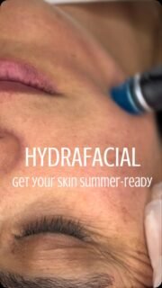 Your skin changes with the seasons… and your skincare should too. ☀️

If your skin is feeling dull, dehydrated or congested after the colder months, now is the perfect time to reset before summer.

HydraFacial deeply cleanses, exfoliates and hydrates your skin in one relaxing treatment, leaving it refreshed, healthier and ready for the months ahead.

Healthy summer skin doesn’t happen by chance. It starts with the right skincare.

📍 Dermacy Clinic • Doncaster

Tell us in the comments… what’s your biggest skin concern before summer? ☀️👇