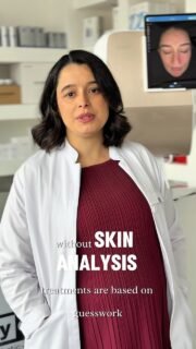 Imagine spending months on the wrong treatment.
Wrong products. Wrong approach. Zero results.
This happens more than you’d think. 🤍
And it almost always starts the same way —
treating the symptom, not the actual skin condition.
That’s exactly why at Dermacy Clinic,
every journey begins with a proper skin analysis.
Our specialist device doesn’t guess.
It shows us precisely what’s happening beneath the surface —
so we treat what’s actually there,
not what it looks like on the outside.
The right diagnosis leads to the right treatment.
Every time.
✨ Special offer:
Book a Hydrafacial at Dermacy Clinic —
and your skin analysis is completely free.
Don’t start your skin journey in the dark.
Start it with clarity. 🤍
📍 Dermacy Clinic • Doncaster
📲 Book now — link in bio
💬 Or DM us to claim your free skin analysis