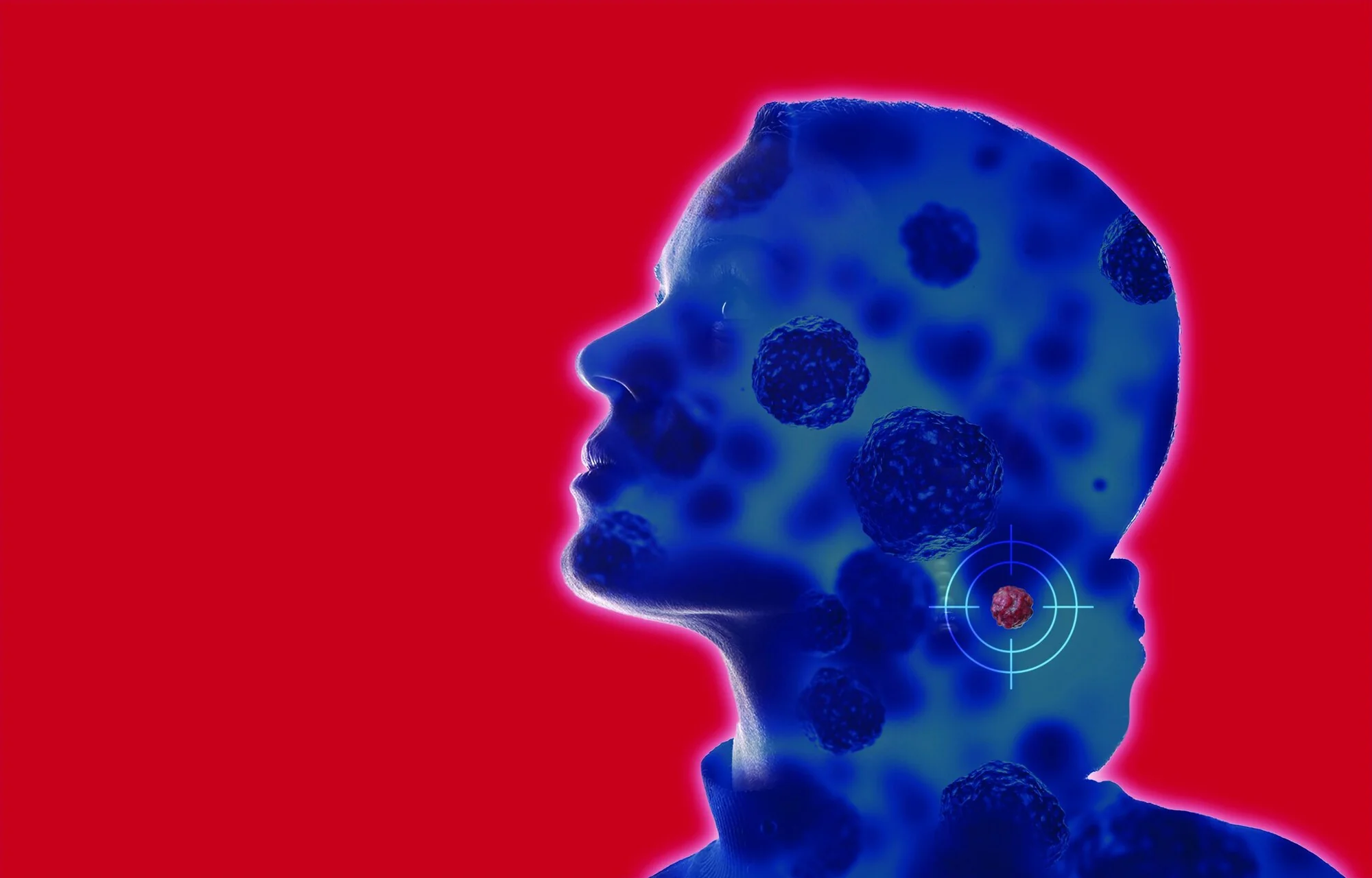 Illustration of a head and neck with cancer cells highlighted, for cancer screening at Memorial