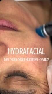 Your skin changes with the seasons… and your skincare should too. ☀️
If your skin is feeling dull, dehydrated or congested after the colder months, now is the perfect time to reset before summer.
HydraFacial deeply cleanses, exfoliates and hydrates your skin in one relaxing treatment, leaving it refreshed, healthier and ready for the months ahead.
Healthy summer skin doesn’t happen by chance. It starts with the right skincare.
📍 Dermacy Clinic • Doncaster
Tell us in the comments… what’s your biggest skin concern before summer? ☀️👇